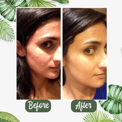 قناع الشاي الأخضر - الصورة 4